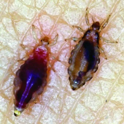 thumbnail for publication: Body Lice and Pubic Lice